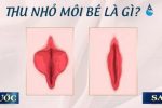 [Chị em nên tham khảo] 10+ Thông tin về thu nhỏ môi bé