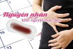 Kinh nguyệt có màu đen ở phụ nữ – Cách điều trị hiệu quả
