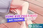 Vùng kín chảy máu bất thường là bị gì – Giải đáp từ bác sĩ