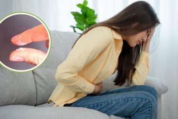 Khám phá cách trị nấm vùng kín an toàn, hiệu quả