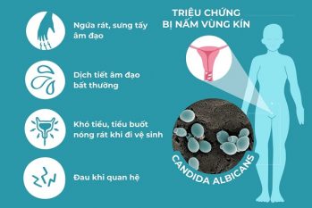 Phát hiện dấu hiệu bị nấm vùng kín phải làm gì?