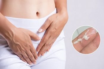 Khí hư màu trắng đục có nên đi khám không?
