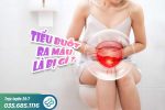 Đi tiểu buốt ra máu ở nữ: Dấu hiệu, nguyên nhân và cách điều trị