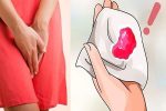 Chảy máu âm đạo bất thường phải làm sao?
