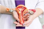 Viêm âm hộ: Nguyên nhân, triệu chứng và cách điều trị
