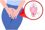 Viêm tuyến Bartholin: Nguyên nhân và Cách chữa hiệu quả