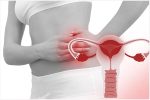Viêm vùng chậu là bệnh gì? Nguyên nhân, Triệu chứng và Cách khắc phục hiệu quả